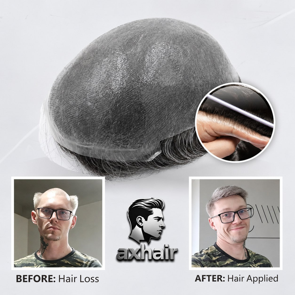 Ultra-thin skin hair system topper with natural hairline, dark hair, thin skin base